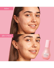 Sephora Favorites  The Glow Up Kit