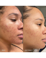Topicals Faded Serum for Dark Spots & Discoloration (Size: 1.7 oz/ 50 mL)