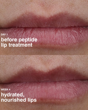Rhode Peptide lip treatment | The nourishing lip layer (Size: 10ml / .3 fl oz.)