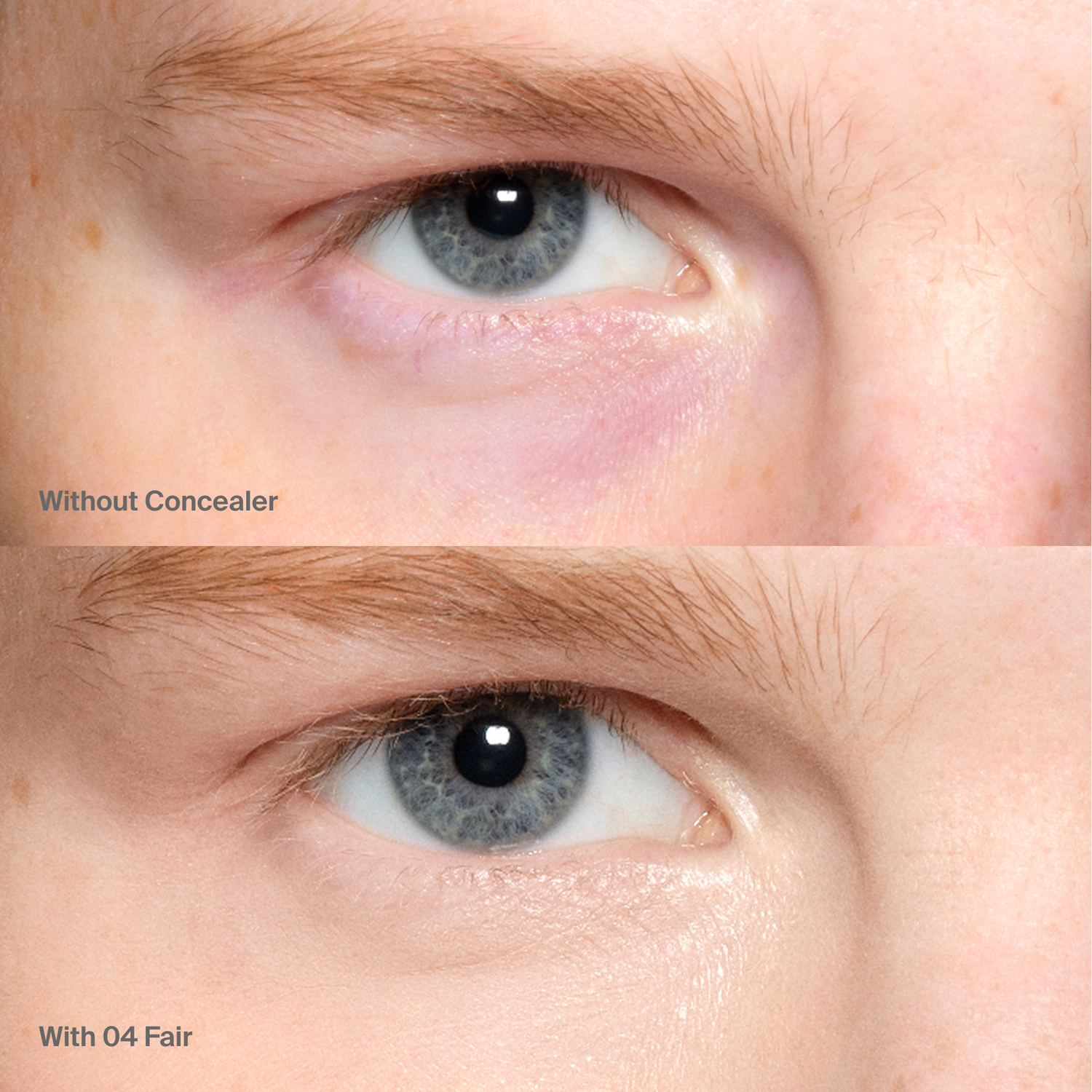 Triclone™ Skin Tech Concealer