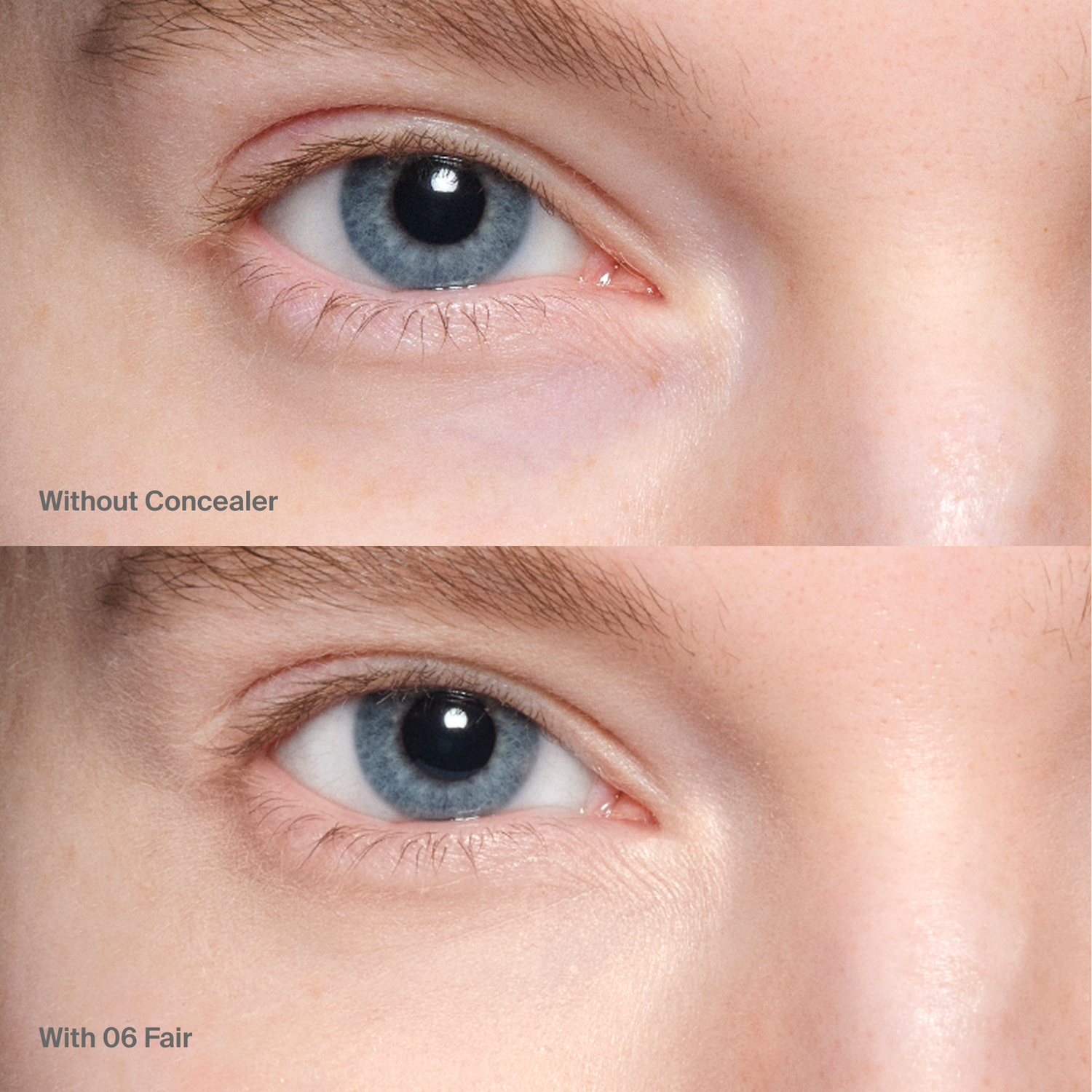 Triclone™ Skin Tech Concealer