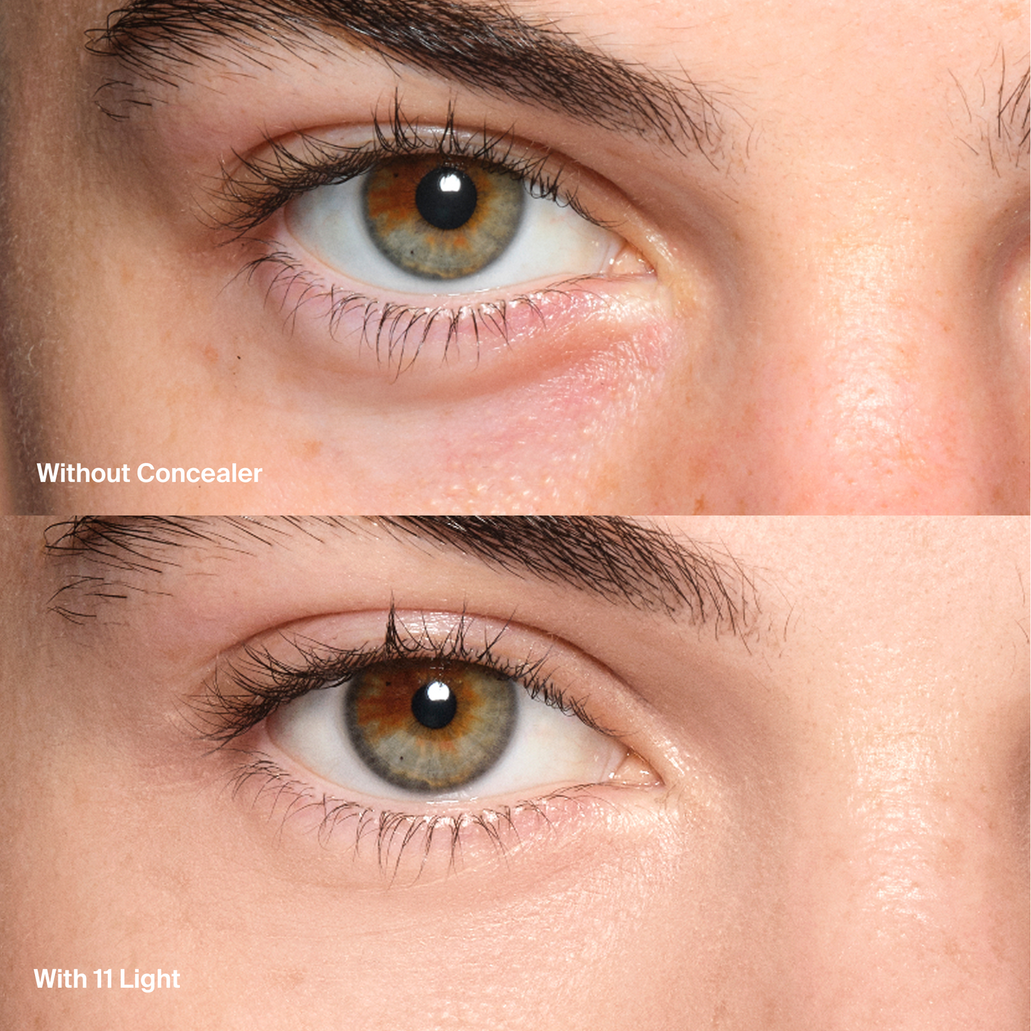 Triclone™ Skin Tech Concealer