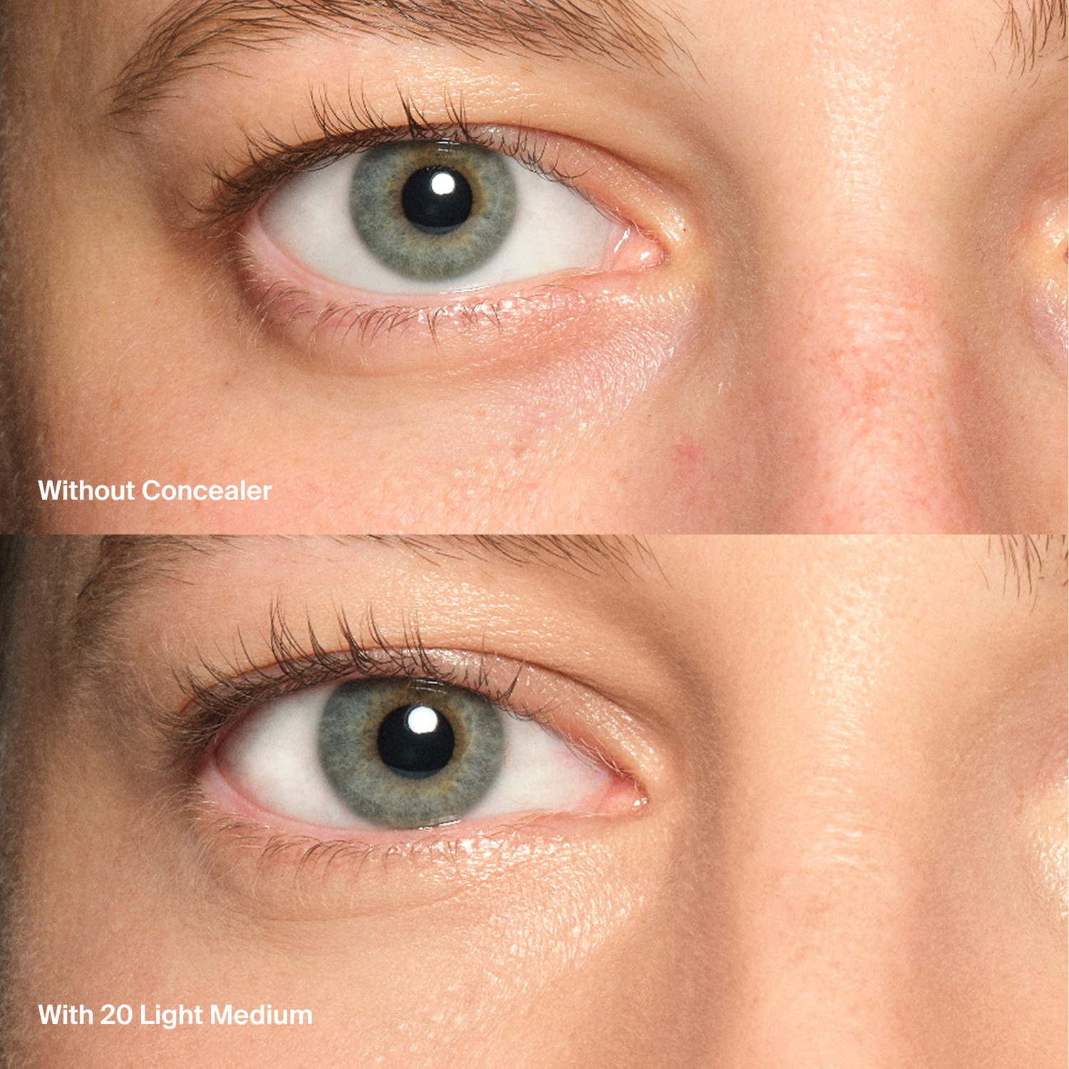 Triclone™ Skin Tech Concealer