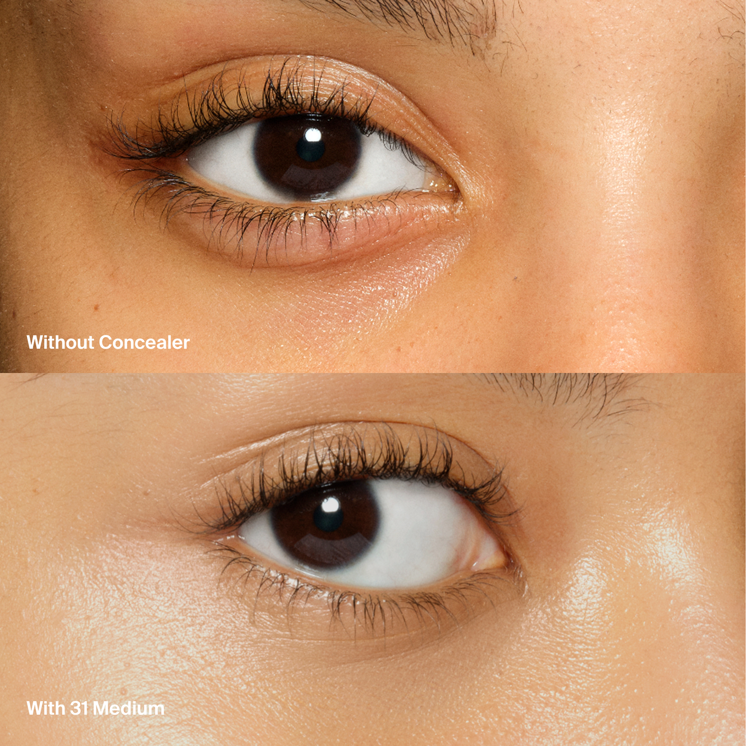 Triclone™ Skin Tech Concealer