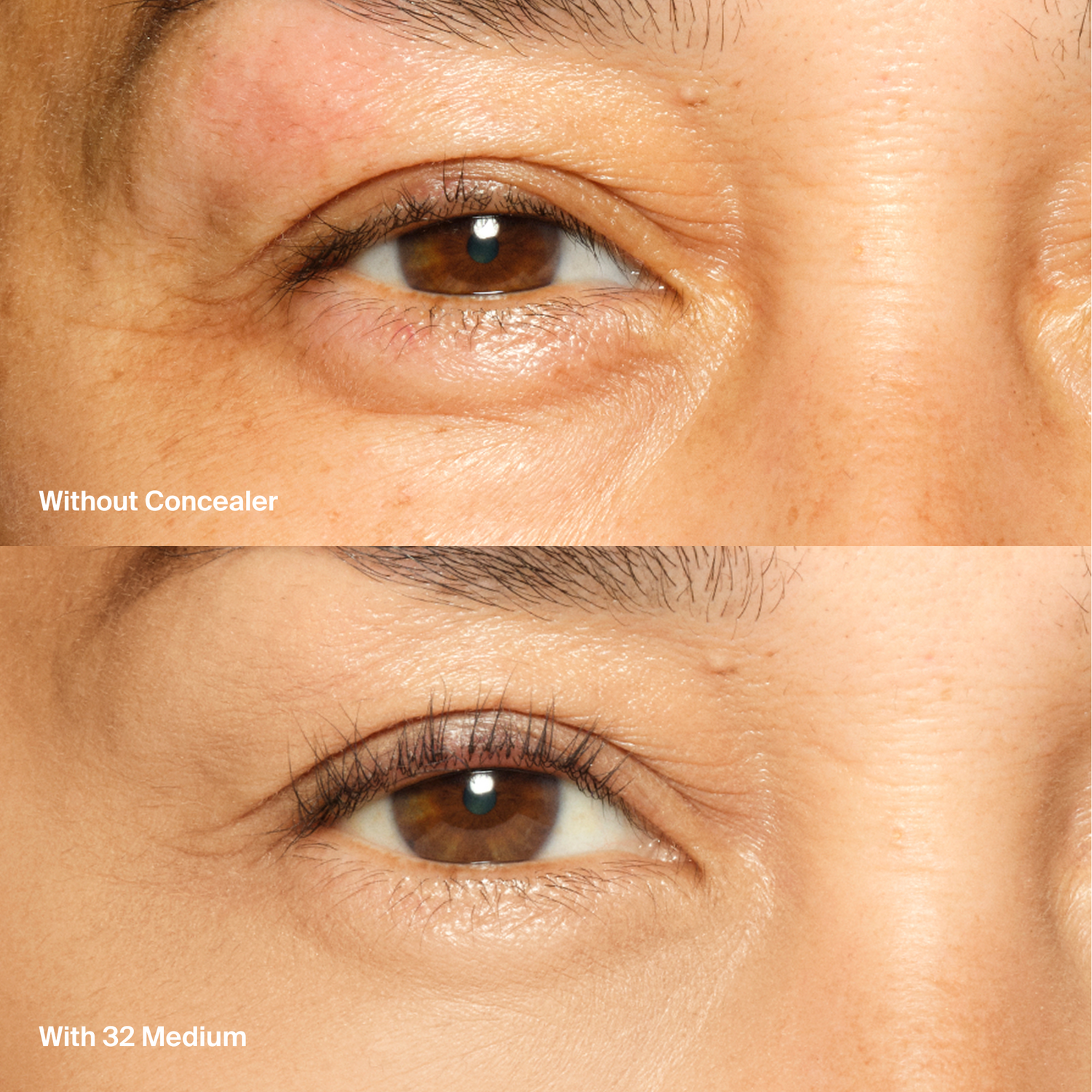 Triclone™ Skin Tech Concealer