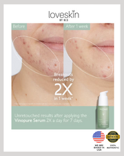 Caudalie 3 Steps Ultimate Radiant Skin Gift Set
